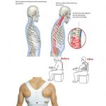 Корректор осанки / корсет "Magnetic Posture Support"